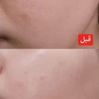 آموزش و خدمات فیشال فوق تخصصی صورت و بدن در کلینیک|خدمات آرایشگری و زیبایی|قم, سالاریه|دیوار