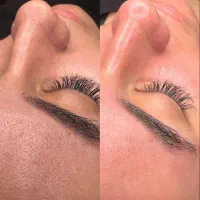 پاکسازی و جوانسازی صورت|خدمات آرایشگری و زیبایی|جم, |دیوار