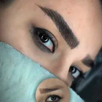 زیبایی نیلگون تخفیف میکروبلیدینگ،فیبروز،فیلر