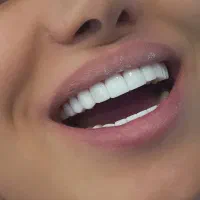 جشنواره زمستان کامپوزیت دندان