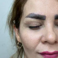 بلفارو پلاستی بالا و پایین|خدمات آرایشگری و زیبایی|تهران, شهران جنوبی|دیوار