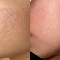 زیبایی|خدمات آرایشگری و زیبایی|تربت جام, المهدی|دیوار