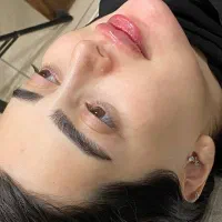 ژل.بوتاکس.انزیم.کات گونه