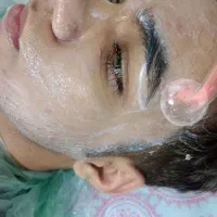 فشیال.هایفو.ازن تراپی پوست ومو.لیفت