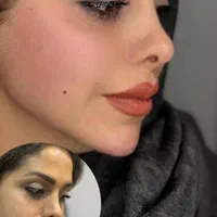 تزریق ژل وجوانسازی تخصصی ومزو ژل،بوتاکس|خدمات آرایشگری و زیبایی|شاهین‌شهر, فردوسی|دیوار