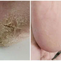 پدیکور ،موخوره گیری،مانیکور خیس،پارافین دست و پا|خدمات آرایشگری و زیبایی|بیرجند, |دیوار