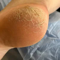 ماساژ درمانی‌ریلکسی‌فشیال،حجامت،پدیکور،مزونیدلینگ|خدمات آرایشگری و زیبایی|قم, عمار یاسر|دیوار