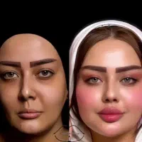 اموزش صفرتا100ژل وبوتاکس