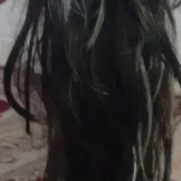 گیس|آرایشی، بهداشتی، درمانی|مشهد, طبرسی شمالی|دیوار