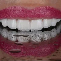 دندانپزشکی یزد|خدمات آرایشگری و زیبایی|رفسنجان, |دیوار