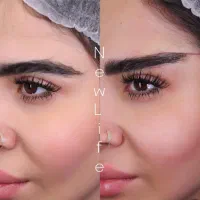 رازجوانی چشم باروش دایرکت ابرو