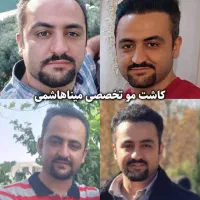 کاشت مو و ابرو