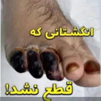 بهبود کامل دیابت به روش های کاملاً گیاهی وتضمینی|خدمات آرایشگری و زیبایی|گنبد کاووس, |دیوار