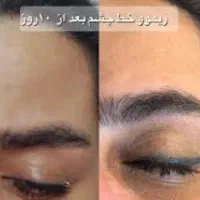 پاک کردن  تتو با اسید میوه با بهترین مواد