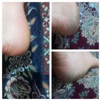 درمان خشکی و ترک پا|آرایشی، بهداشتی، درمانی|تربت جام, امام|دیوار