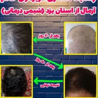 تونیک ضد ریزش مو و تقویت مو|آرایشی، بهداشتی، درمانی|یزد, |دیوار