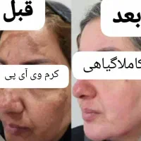 زیبایی خودتان رابه رخ بکشید|آرایشی، بهداشتی، درمانی|کازرون, |دیوار