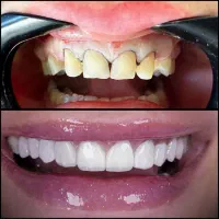 درمانگاه دندانپزشکی تخصصی دکتر دانشور|خدمات آرایشگری و زیبایی|شیراز, معالیآباد|دیوار