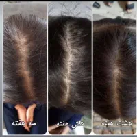 معجزه با اکسیر های سلامتی|خدمات آرایشگری و زیبایی|چناران, |دیوار