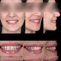 ارتودنسی توسط متخصص اقساطی بدون چک مشاوره رایگان