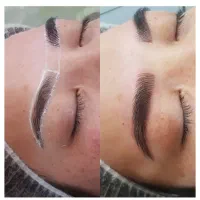 میکروبلیدینگ میکروپگمنتیشن