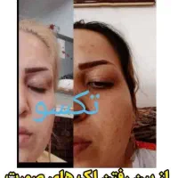 با ما بدرخشید واز شرلک هات خلاص شو|خدمات آرایشگری و زیبایی|باشت, |دیوار