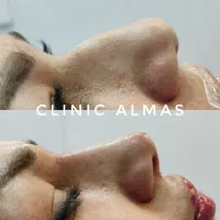 خدمات فیلربینی وصورت