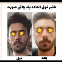 (چاقی طبیعی صورت)با پودر جوانه گندم