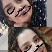 روشن کننده و رفع هرنوع مشکل پوستی بدون بازگشت