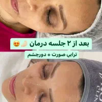 پاکسازی پوست فیشال پوست فیشیال پوست|خدمات آرایشگری و زیبایی|تهران, مجیدیه|دیوار