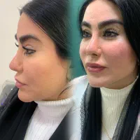 کلینیک زیبایی/فیلربادی و صورت/بوتاکس/لیفت نخ