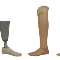 کلینیک تخصصی ساخت پروتز پیشرفته پای مصنوعی|خدمات آرایشگری و زیبایی|فامنین, |دیوار