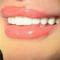 کامپوزیت فقط ۶ ملیون به مدت محدود