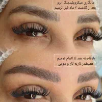 میکروبلیدینگ سوپرنچرال با شرایط ویژه|خدمات آرایشگری و زیبایی|رشت, گلسار|دیوار