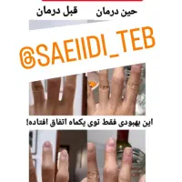 رماتیسم،نقرس ،ارتریت روماتوئید|آرایشی، بهداشتی، درمانی|بندر انزلی, گیلار|دیوار