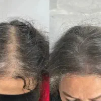 مدل دستمزد رایگان اسکالپ مو خانم ها توسط استاد|خدمات زیبایی و سلامت|تهران, میرداماد|دیوار