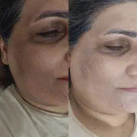 فیشال تخصصی درخشش۱۲ مرحله ایی پوست شما