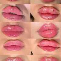 لیزر موی‌ زاید بوتاکس‌ ژل‌ لب مزو آنزیم بینی لیفت