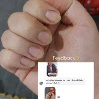 سرمدوفازناخن|آرایشی، بهداشتی، درمانی|جوانرود, |دیوار