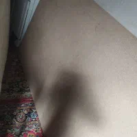 تخت خواب طبی|تخت و سرویس خواب|زاهدان, |دیوار