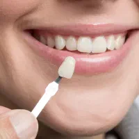 پایینترین قیمت دندانپزشکی در استان