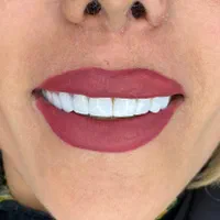 دندانپزشکی اورژانسی در شرایط فعلی
