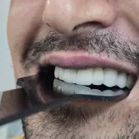 ساخت انواع دست دندان و روکش و لمینت ....