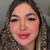 تخفیف ویژه خدمات ژل و‌بوتاکس