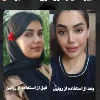 بینی|آرایشی، بهداشتی، درمانی|تهران, آسمان|دیوار