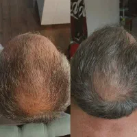 نتیجه استفاده رو ببین