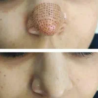 خدمات آرایش دائم و ریمو|خدمات آرایشگری و زیبایی|اردبیل, |دیوار