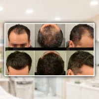 کچل نمیری..|آرایشی، بهداشتی، درمانی|تهران, نجات اللهی|دیوار