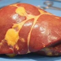 بهبود دیابت با یه دوره دو ماهه با طب سنتی