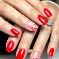 کاشت اولیه ۳۰۰